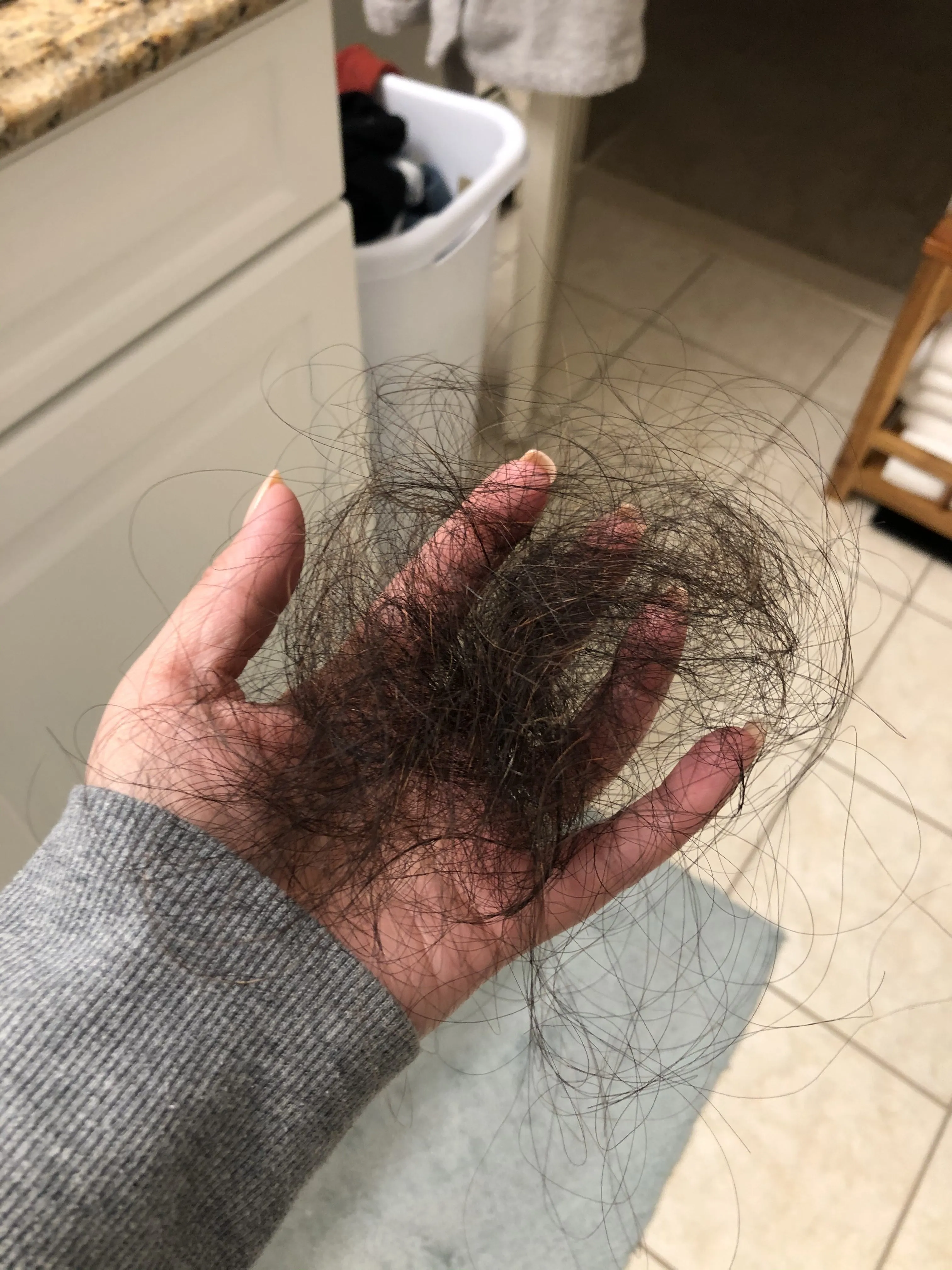 Just a little hair loss.